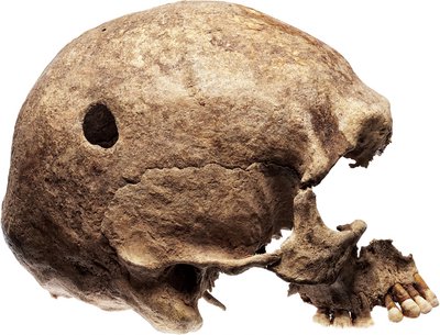 kranium