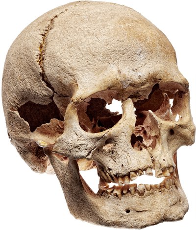 kranium
