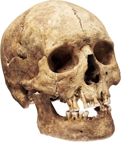 kranium